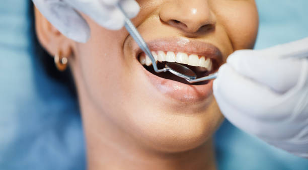 Best Emergency Wisdom Tooth Extraction in China Grove, TX